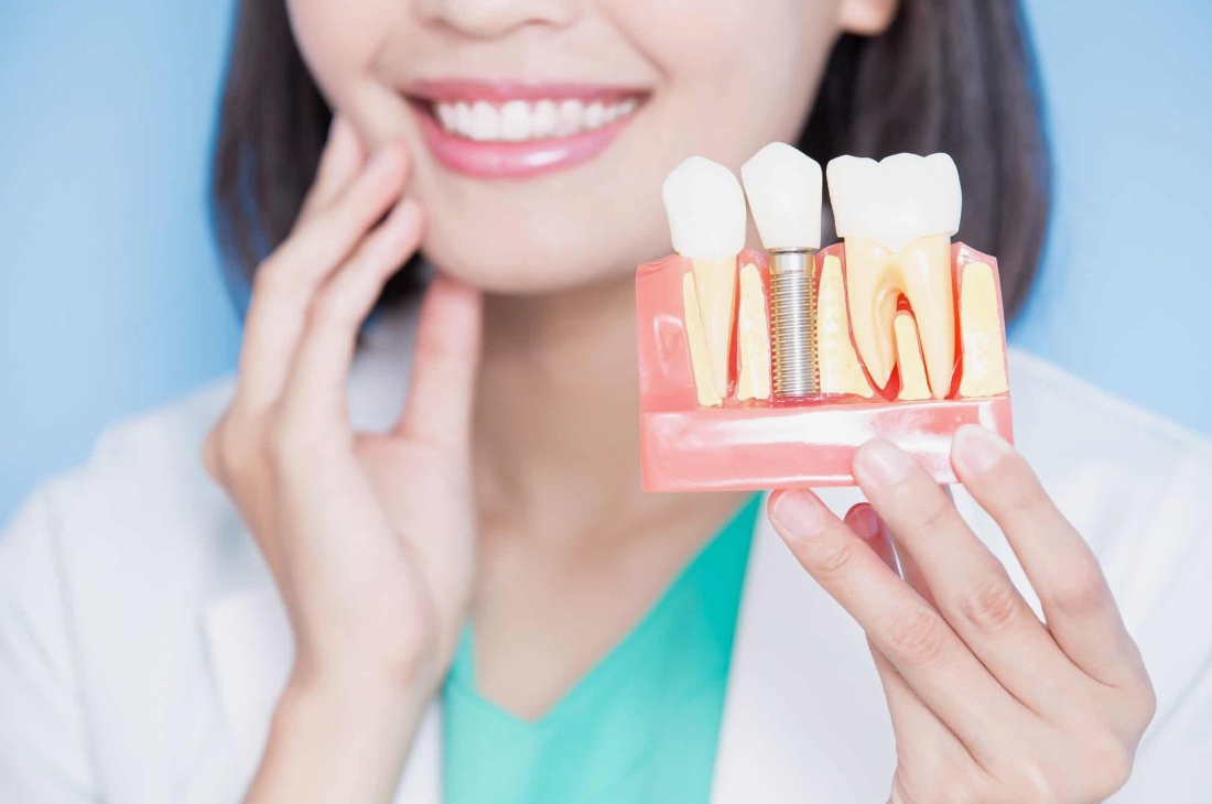 Dental Implants Turkey