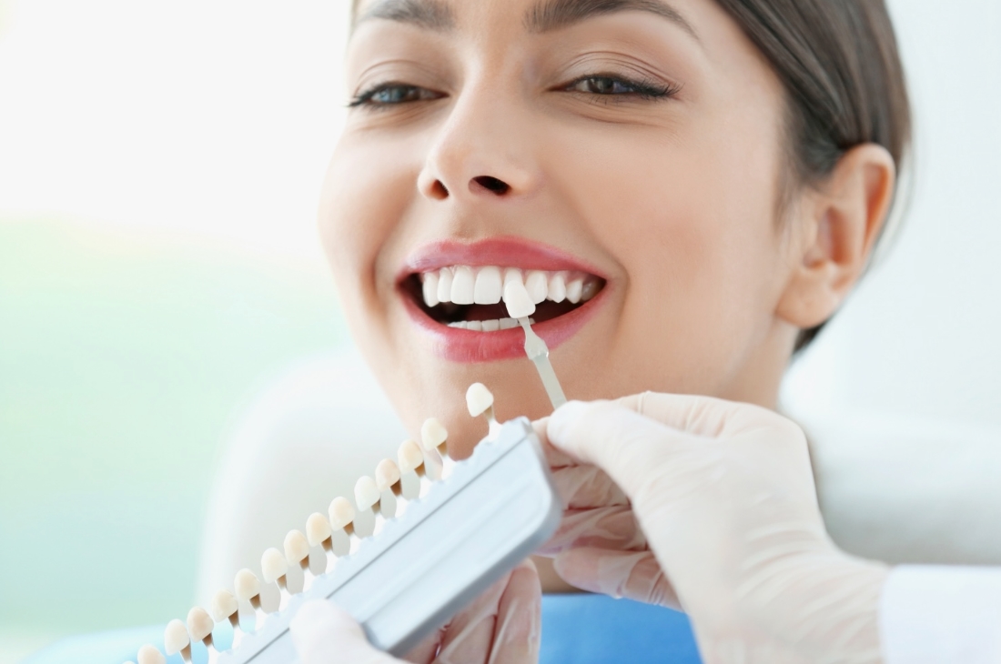 Dental Veneers Turkey
